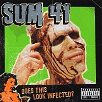 ＳＵＭ　４１「 ダズ・ディス・ルック・インフェクテッド？」