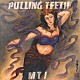 ＰＵＬＬＩＮＧ　ＴＥＥＴＨ「ＭＴＪ」