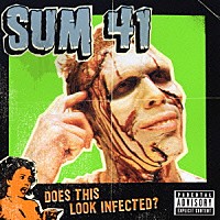 ＳＵＭ　４１「 ダズ・ディス・ルック・インフェクテッド？」